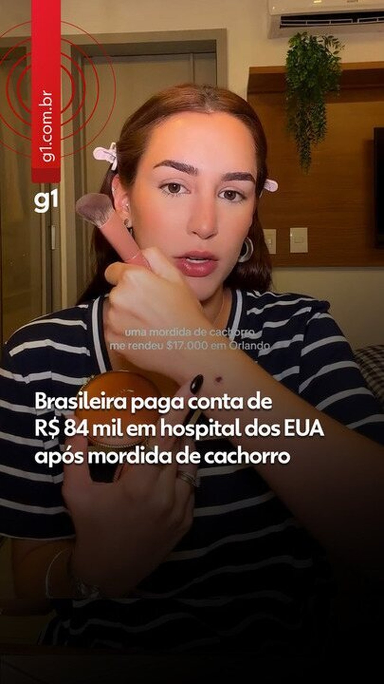 Brasileira recebe conta de R$ 84 mil em hospital dos EUA após mordida de cachorro